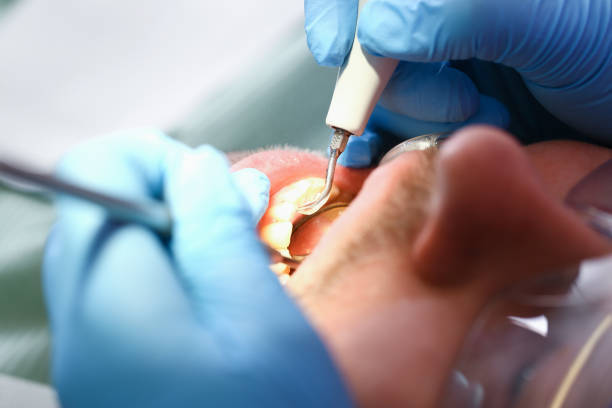 Best Emergency Dental Services for Seniors in Eclectic, AL