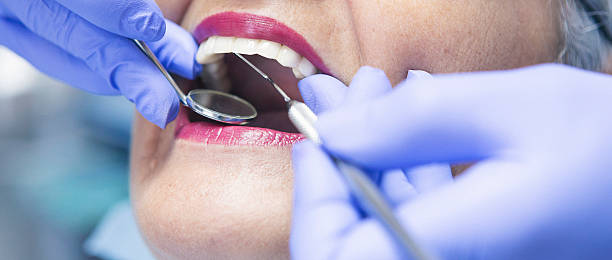 Best Emergency Dentist for Lost Fillings or Crowns in Eclectic, AL